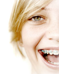 girl with braces smiling