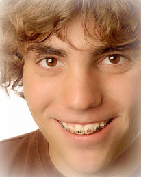 young teenage boy with braces and smiling